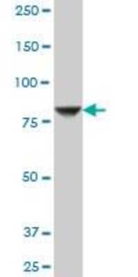 Western Blot: STIM1 Antibody (5A2) [H00006786-M01]