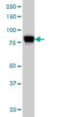 Western Blot: STIM1 Antibody (5A2) [H00006786-M01]