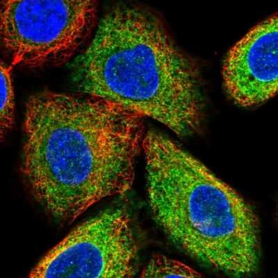 Immunocytochemistry/ Immunofluorescence: STIM1 Antibody [NBP1-84322]