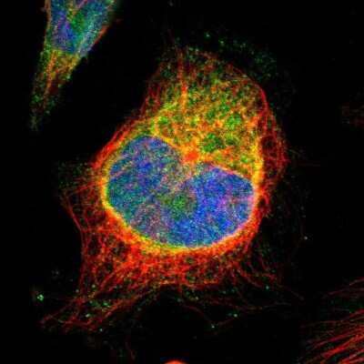 Immunocytochemistry/ Immunofluorescence: STIM1 Antibody [NBP1-84323]