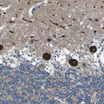Immunohistochemistry-Paraffin: STIM1 Antibody [NBP1-84323]