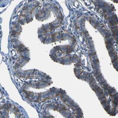 Immunohistochemistry-Paraffin: STIM1 Antibody [NBP1-84323]