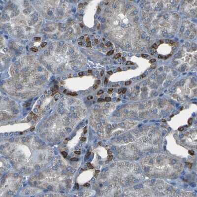 Immunohistochemistry-Paraffin: STIM1 Antibody [NBP1-84323]