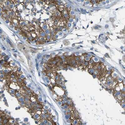 Immunohistochemistry-Paraffin: STIM1 Antibody [NBP1-84323]