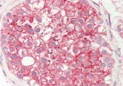 Immunohistochemistry-Paraffin: STIM1 Antibody [NBP2-44168]