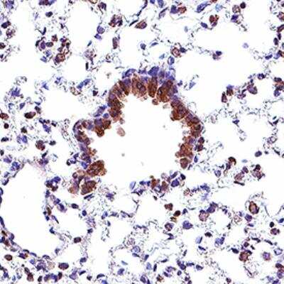 Immunohistochemistry: STING/TMEM173 Antibody (2922D) [NBP3-18816]