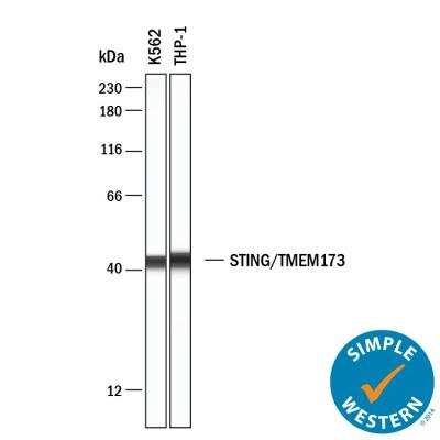 Simple Western: STING/TMEM173 Antibody (2922D) [NBP3-18816]