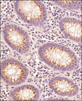 Immunohistochemistry-Paraffin: STING/TMEM173 Antibody - BSA Free [NBP2-24683]