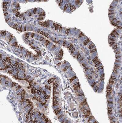 Immunohistochemistry-Paraffin: STING/TMEM173 Antibody [NBP2-38389]