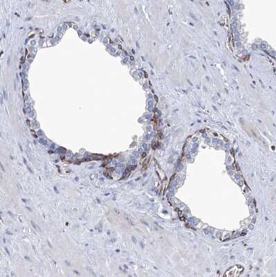 Immunohistochemistry-Paraffin: STING/TMEM173 Antibody [NBP2-38389]