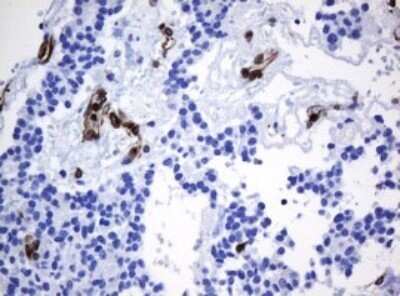Immunohistochemistry: STING/TMEM173 Antibody (OTI4H1) - Azide and BSA Free [NBP2-74402]