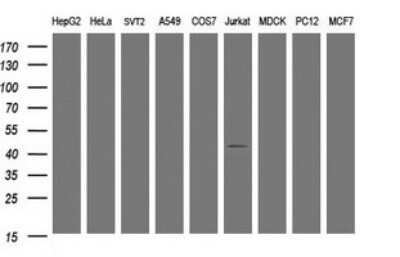 Western Blot: STING/TMEM173 Antibody (OTI4H1)Azide and BSA Free [NBP2-74402]