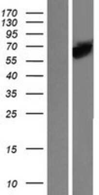 Western Blot: STI1 Overexpression Lysate [NBP2-07574]