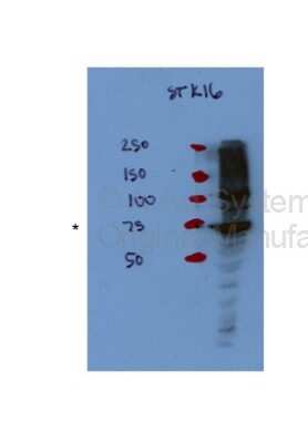 Western Blot: STK16 Antibody [NBP1-56541]