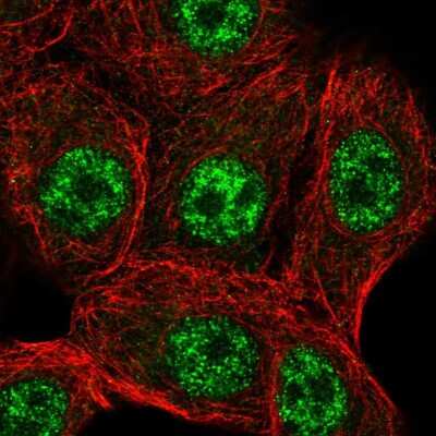 Immunocytochemistry/ Immunofluorescence: STK19 Antibody [NBP2-57152]