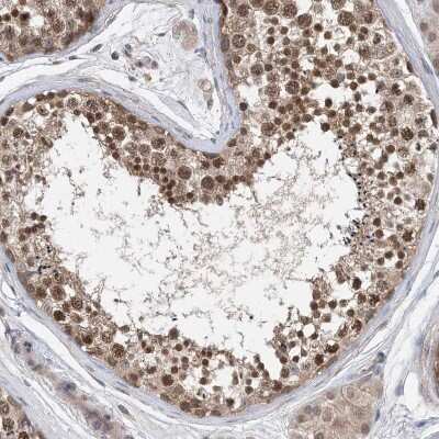 Immunohistochemistry-Paraffin: STK19 Antibody [NBP1-84308]