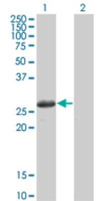 Western Blot: STK22C Antibody (3G8) [H00081629-M02]