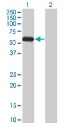 Western Blot: STK25 Antibody (1G6) [H00010494-M01]