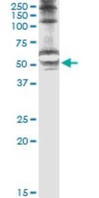 Immunoprecipitation: STK25 Antibody (4B10) [H00010494-M02]