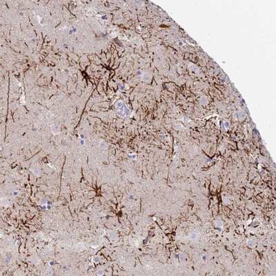 Immunohistochemistry-Paraffin: STK25 Antibody [NBP1-92453]