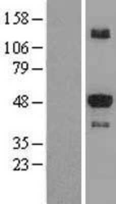 Western Blot: STK25 Overexpression Lysate [NBL1-16545]