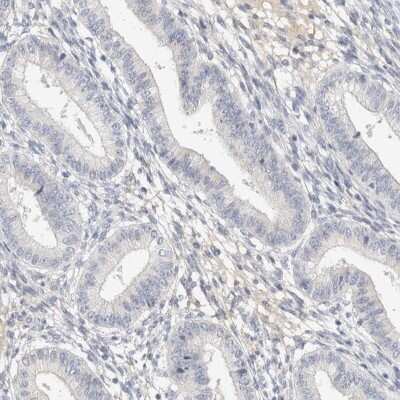 Immunohistochemistry-Paraffin: STK31 Antibody [NBP1-80759]