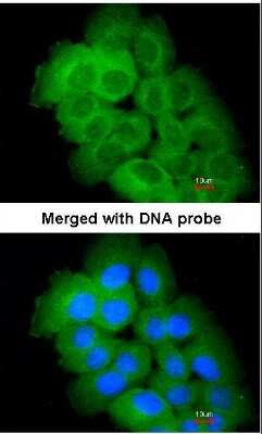 Immunocytochemistry/ Immunofluorescence: STK32C Antibody [NBP1-33507]