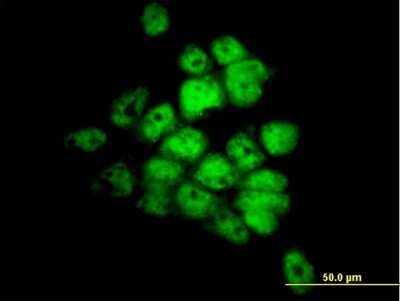 Immunocytochemistry/ Immunofluorescence: STK33 Antibody (1F10) [H00065975-M09]