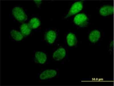 Immunocytochemistry/ Immunofluorescence: STK33 Antibody (6G1) [H00065975-M02]
