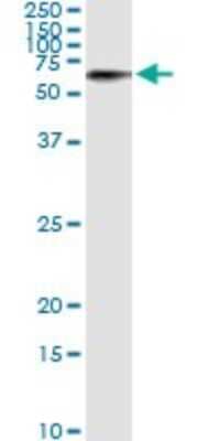Immunoprecipitation: STK33 Antibody (6G1) [H00065975-M02]