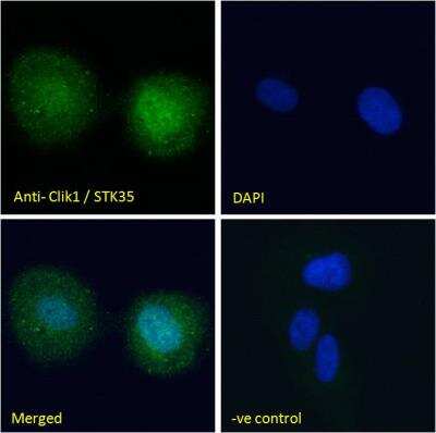 Immunocytochemistry/ Immunofluorescence: STK35 Antibody [NB100-1393]