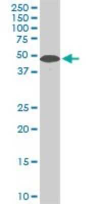Western Blot: STK38 Antibody (2F3) [H00011329-M04]