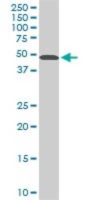 Western Blot: STK38 Antibody (2F3) [H00011329-M04]