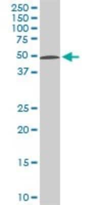 Western Blot: STK38 Antibody (2F3) [H00011329-M04]