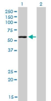 Western Blot: STK38 Antibody (2F3) [H00011329-M04]