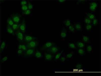 Immunocytochemistry/ Immunofluorescence: STK38 Antibody (2F6) [H00011329-M11]