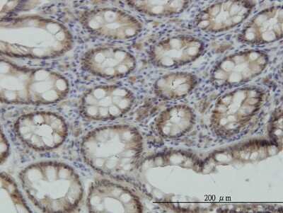 Immunohistochemistry-Paraffin: STK38 Antibody (2F6) [H00011329-M11]