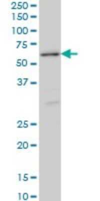 Western Blot: STK38 Antibody (2F6) [H00011329-M11]