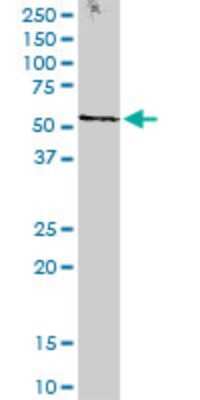 Western Blot: STK38 Antibody (2F6) [H00011329-M11]