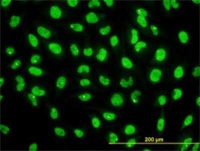 Immunocytochemistry/ Immunofluorescence: STK38 Antibody (2G8-1F3) [H00011329-M01]