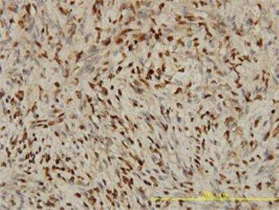Immunohistochemistry-Paraffin: STK38 Antibody (2G8-1F3) [H00011329-M01]