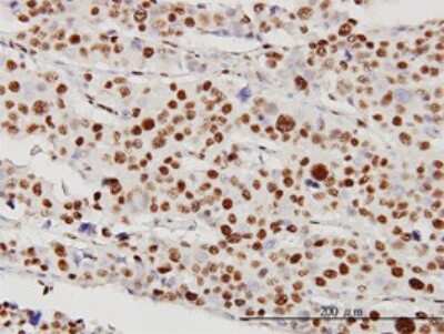 Immunohistochemistry-Paraffin: STK38 Antibody (2G8-1F3) [H00011329-M01]
