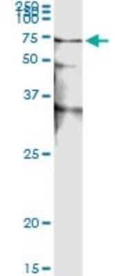 Immunoprecipitation: STK38 Antibody (2G8-1F3) [H00011329-M01]