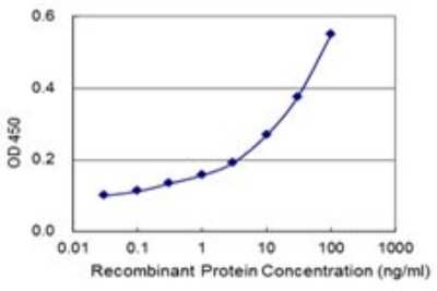 ELISA: STK38 Antibody (2G8-1F3) [H00011329-M01]