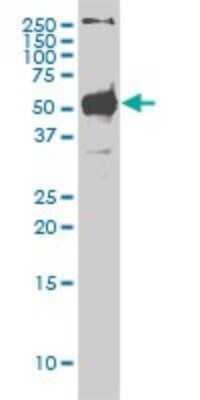 Western Blot: STK38 Antibody (2G8-1F3) [H00011329-M01]