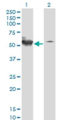 Western Blot: STK38 Antibody (2G8-1F3) [H00011329-M01]