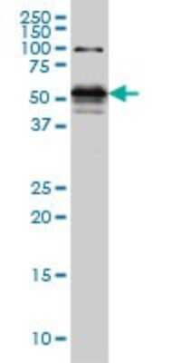 Western Blot: STK38 Antibody (6G11) [H00011329-M05]