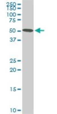 Western Blot: STK38 Antibody (6G11) [H00011329-M05]