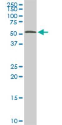 Western Blot: STK38 Antibody (6G11) [H00011329-M05]