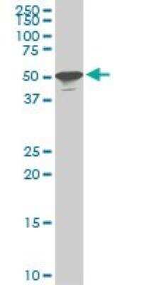 Western Blot: STK38 Antibody (6G11) [H00011329-M05]